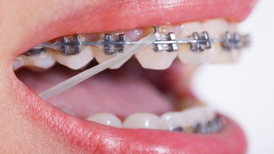 What Is An Orthodontist